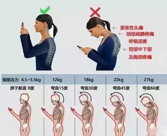 低头玩手机 谋杀颈椎与双下巴的隐形杀手